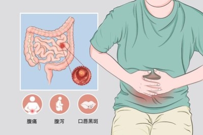 世界腸道日濟南肛泰建議多點“腸”識健康“腸”伴(圖3)